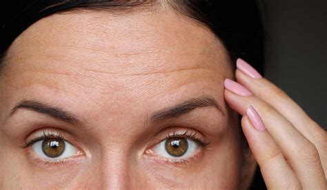 Lo Que Tus Arrugas Faciales Pueden Tratar De Decirte
