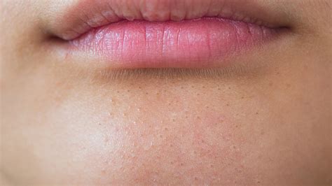 What Really Causes Blackheads On Your Chin