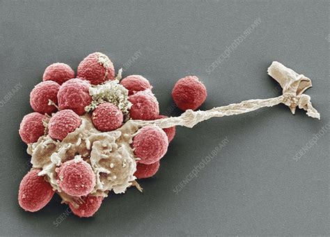 Phagocytosis Of Fungal Spores Sem Stock Image P2660122 Science