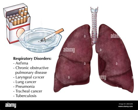 An Illustration Depicting Cigarettes And A Pair Of Lungs Affected By