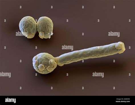 Candida Albicans Fungus Coloured Scanning Electron Micrograph Sem