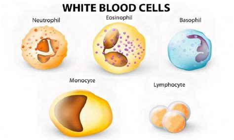 Leukemia And Wbcs Symptoms Causes Types Diagnosis And Treatment