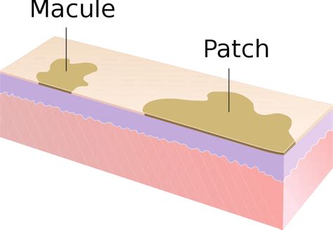 Dermatologie Grundlagendiagnostik And Aufbau Der Haut