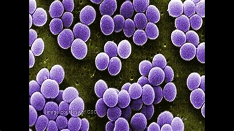 Staphylococcus Aureus Youtube
