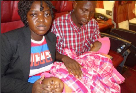 Conjoined Nigerian twins finally separated (Photos)