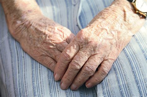 Elderly Womans Hands Stock Image C0096844 Science Photo Library
