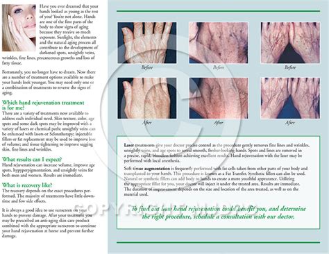 Hand Rejuvenation Treatments Mjd Patient Communications
