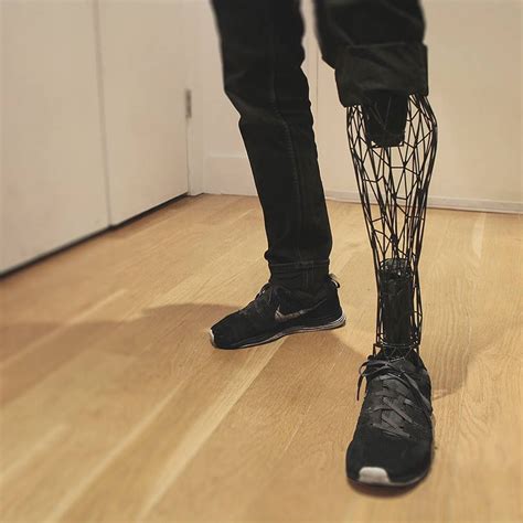 A Prosthetic Leg Designed By Industrial Designer William Root Using 3d