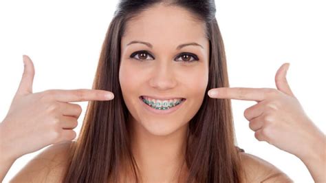 Simply How Much Do Various Types Of Braces Cost These Days Leverage Ratio