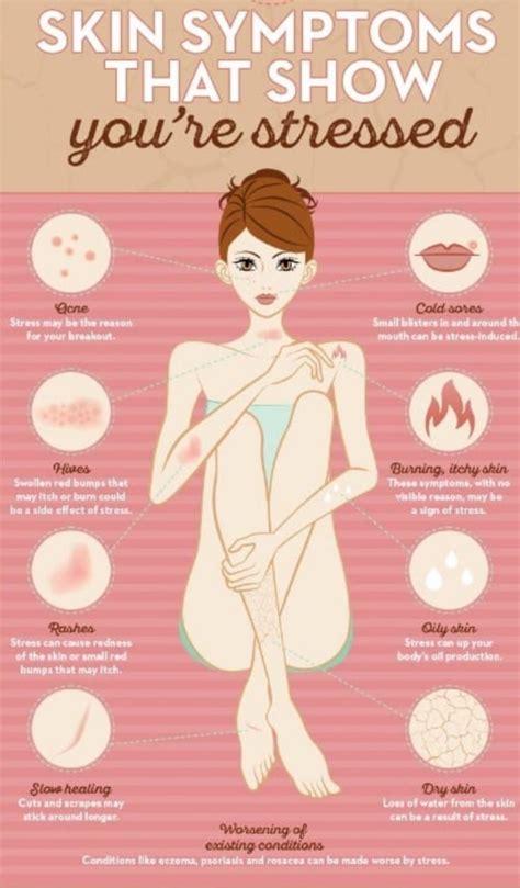 How To Know If You Are Stressed 😩 Skin Symptoms Skin Care Health