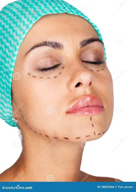 Marking For Cosmetic Plastic Surgery Stock Photo Image Of Closeup