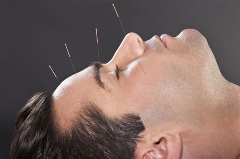 Pro-Health Acupuncture Center at Scott Dixon blog