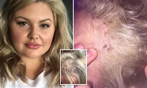 This allows you to gradually work your way to. Woman left with horrific burns after having her regrowth ...