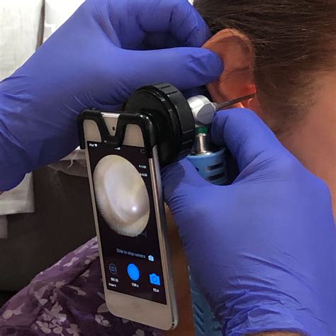 How to remove ear wax. Endoscopic Microsuction - The Ear Wax Removal Specialists