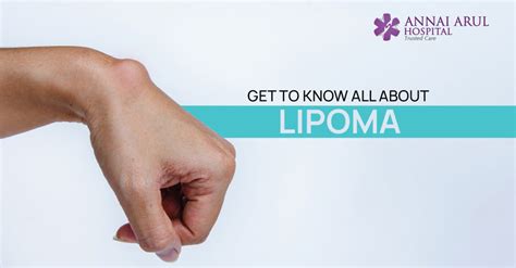 Get To Know All About Lipoma Multispeciality Hospitals In Chennai