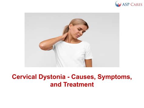 Cervical Dystonia Causes Symptoms And Treatment By Tim Pain Issuu