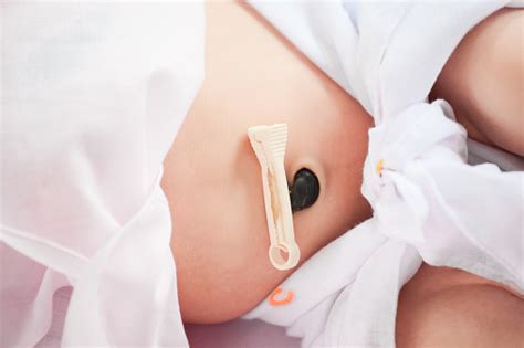 This can be a pleasurable experience for you and your baby. Closeup Umbilical Cord With Clamp Of Newborn Baby Stock ...