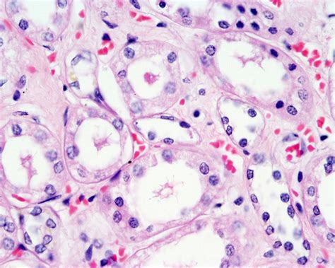 Filerenal Histology 05 Embryology