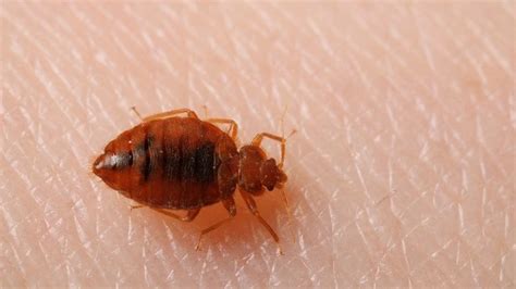 Does Vinegar Kill Bed Bugs Effective Home Remedy