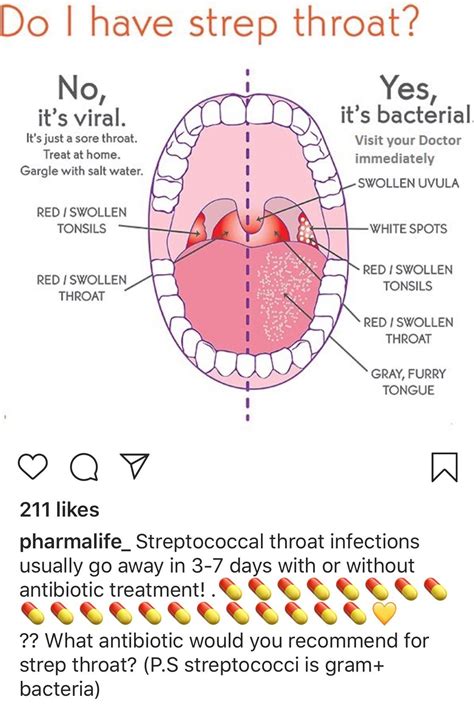 Yellow Spots In Throat
