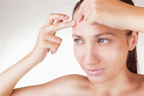 7 Easy Ways To Prevent Forehead Acne And Treatment
