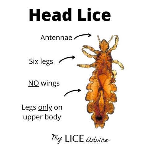 What Lice Look Like Pictures Of Lice Color Size And More