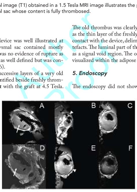 The Spin Echo T2 Weighted Mr Images A B C E F And T2 Parametric Download Scientific
