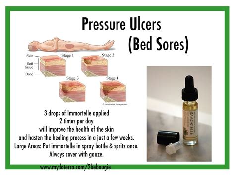 A Decubitus Ulcer Also Called A Pressure Sore Or Bed Sore Is An Open