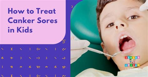 Effective Canker Sore Treatment For Kids Junior Smiles Of Stafford