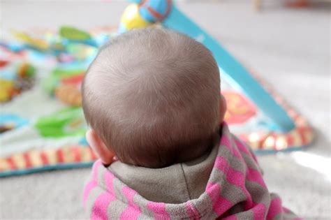 How To Prevent A Bald Spot From Developing On The Back Of A Babys Head