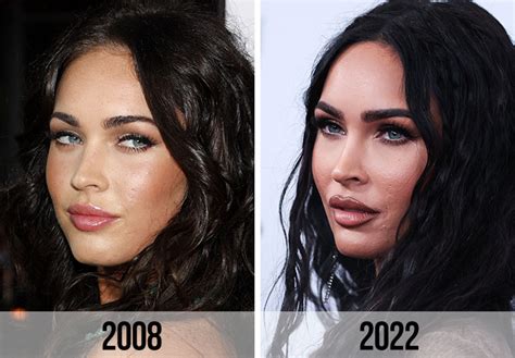 Megan Fox Reportedly Seen Leaving A Plastic Surgeons Office In A
