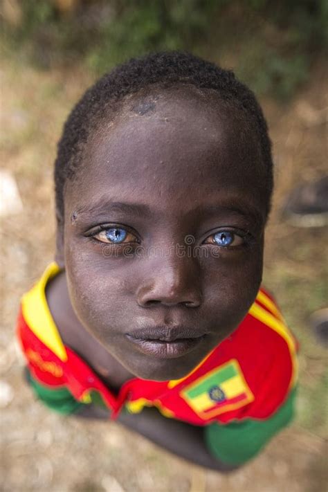 African Boy With Blue Eyes Editorial Stock Photo Image Of Blue
