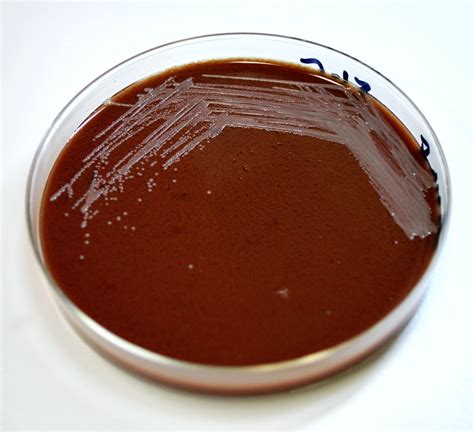 Free Picture Chocolate Agar Inoculated Gram Negative Francisella