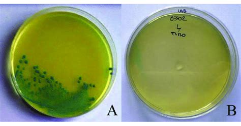 Growth Of L Innocua On Chromogenic Aloa Agar Listeria Acc To