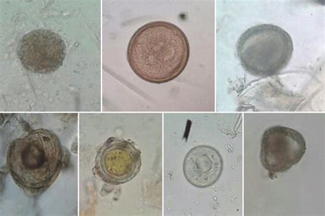 Images Showing Intestinal Parasites Identified In Immigrant Barn