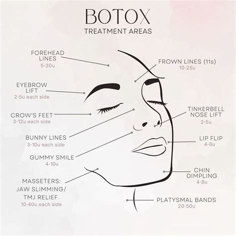 What Areas Can You Get Botox In 2024 Botox Botox Clinic Facial Aesthetics