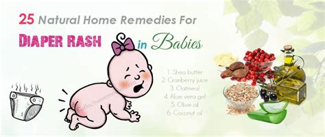 With These 25 Natural Home Remedies For Diaper Rash In Babies You Will