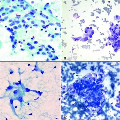 A Reactivereparative Epithelial Cells With Large Oval Nuclei Fine