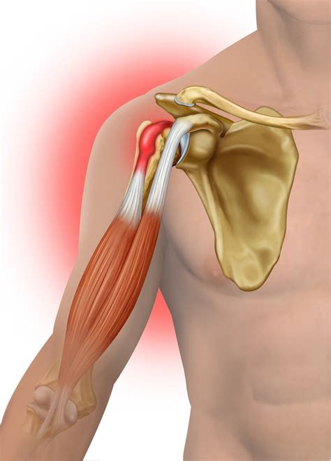Distal Biceps Orthopedic Centers Of Colorado