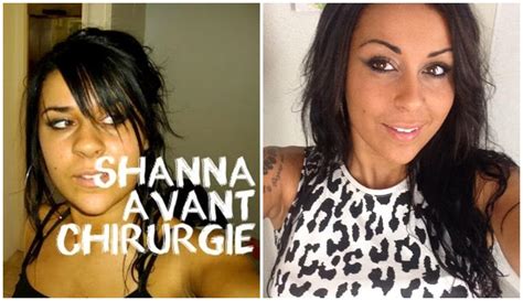 En 2017, après plus d'un an de relation, jessica thivenin annonçait sa séparation d'avec nikola lozina. Les candidats de télé réalité avant après chirurgie