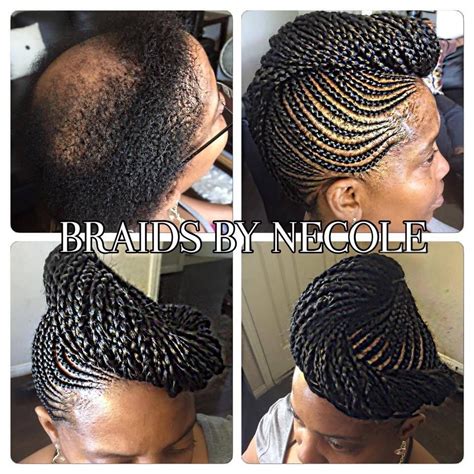 18 Divine Braided Hairstyles To Cover Alopecia