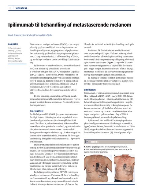 PDF Ipilimumab Treatment Of Metastatic Melanoma