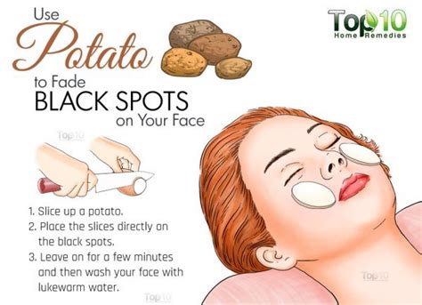 Home Remedies For Black Spots On Your Face Top 10 Home