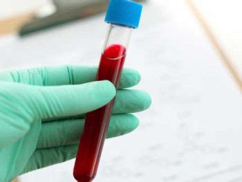 Para que serve o hemograma o popular exame de sangue Laboratório São Manuel