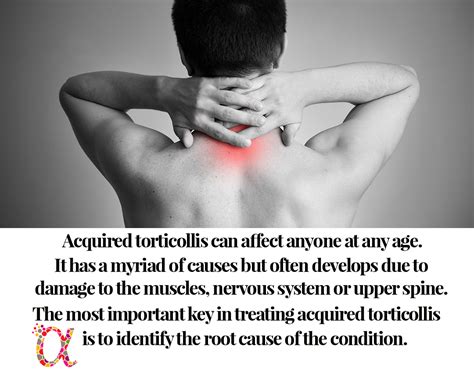 Chiropractic Treatment Of Torticollis Neck Pain Advanced Wellness