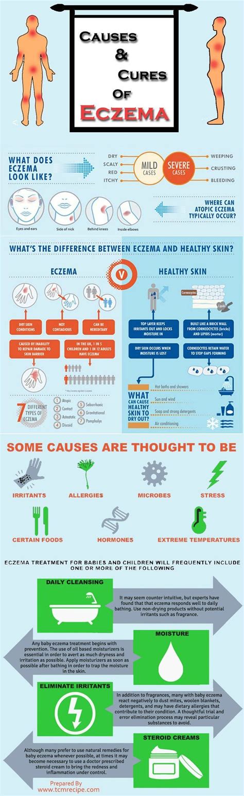 Causes And Cures Of Eczema Infographics Current Events Post