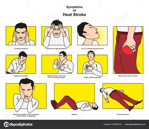 Symptoms Heat Stroke Infographic Diagram Including Headache Dizziness