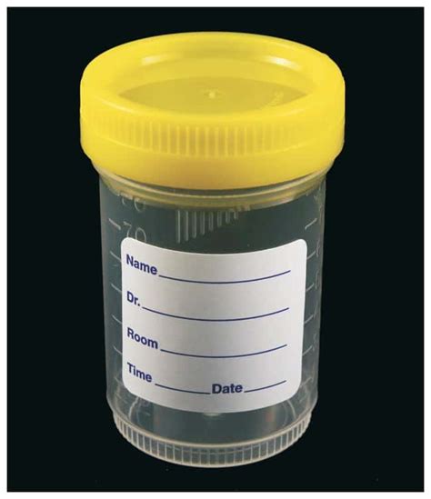 Parter Medical Products Sterile Specimen Containers 48mm Opening 90ml