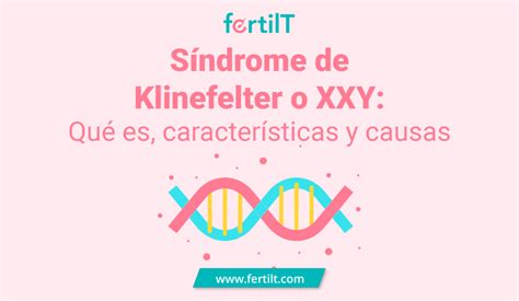 S Ndrome De Klinefelter O Xxy Qu Es Caracter Sticas Y Causas Free