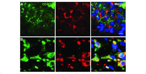 Representative Microphotographs Of Double Immunofluorescence For C1q